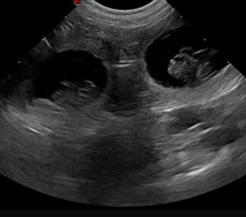 🌸 Confirmation de gestation Vanity 🌸